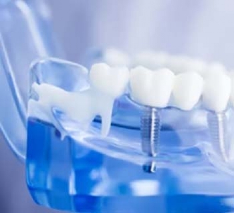 Clínicas Odontológicas Pediátricas Parque Industrial - Clínica Odontológica Implantes