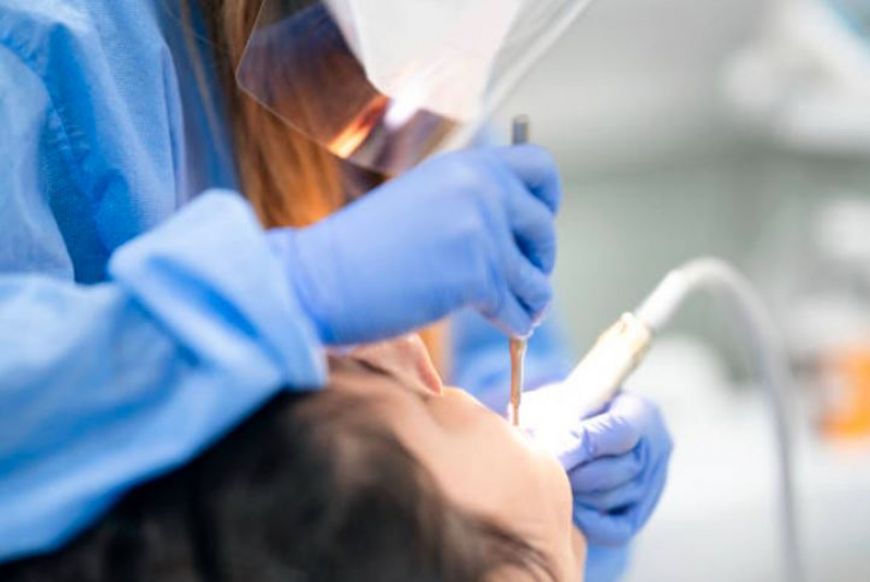 Mini Implantes Ortodôntico Gramado - Tratamento Odontológico Matão