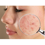 Clínica de Alergia e Dermatologia