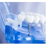 Clínica Odontológica Implantes