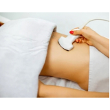exame ultrassom abdominal total agendar Carlos Gomes
