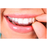 implantes de dentadura Jardim Chapadão
