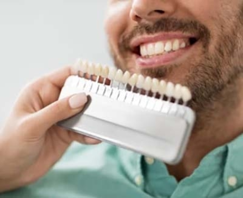Tratamento em Clínica 24 Horas Dentista Cidade Singer - Clínica Odontológica Campinas