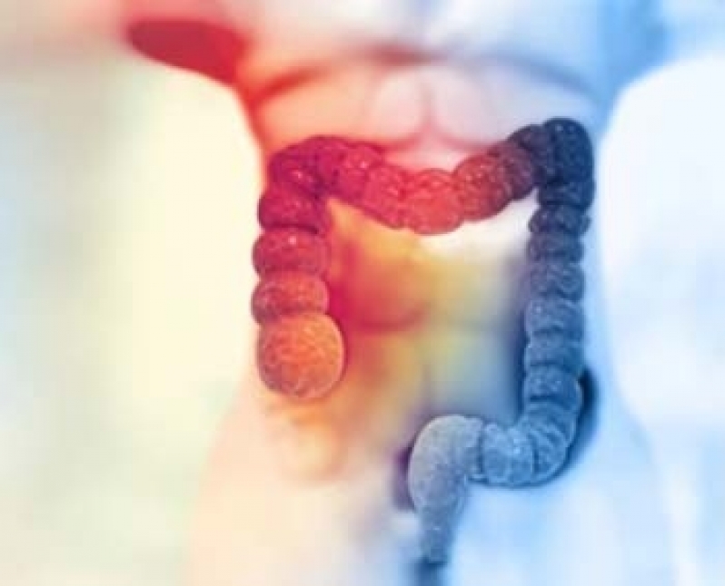 Tratamento em Clínica Gastro Diagnostico Sumaré - Gastroenterologia Clínica