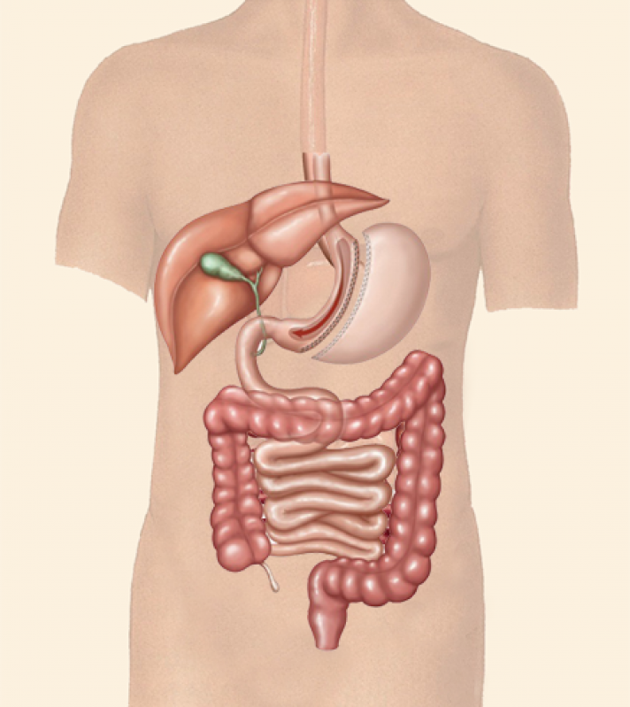 Tratamento em Clínica Gastro Pediatra DIC III - Clínica Gastroenterologista Clínica Sim